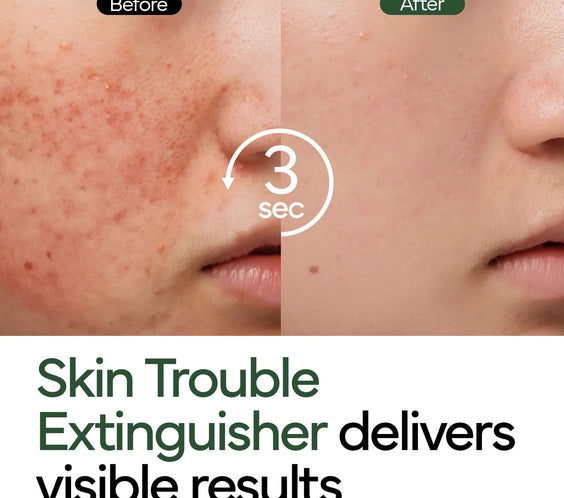 Intensive Cica Repair Cream - ivoskin