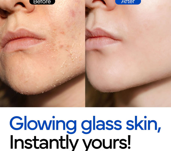 Hydrating Rice Bubble Toner - ivoskin