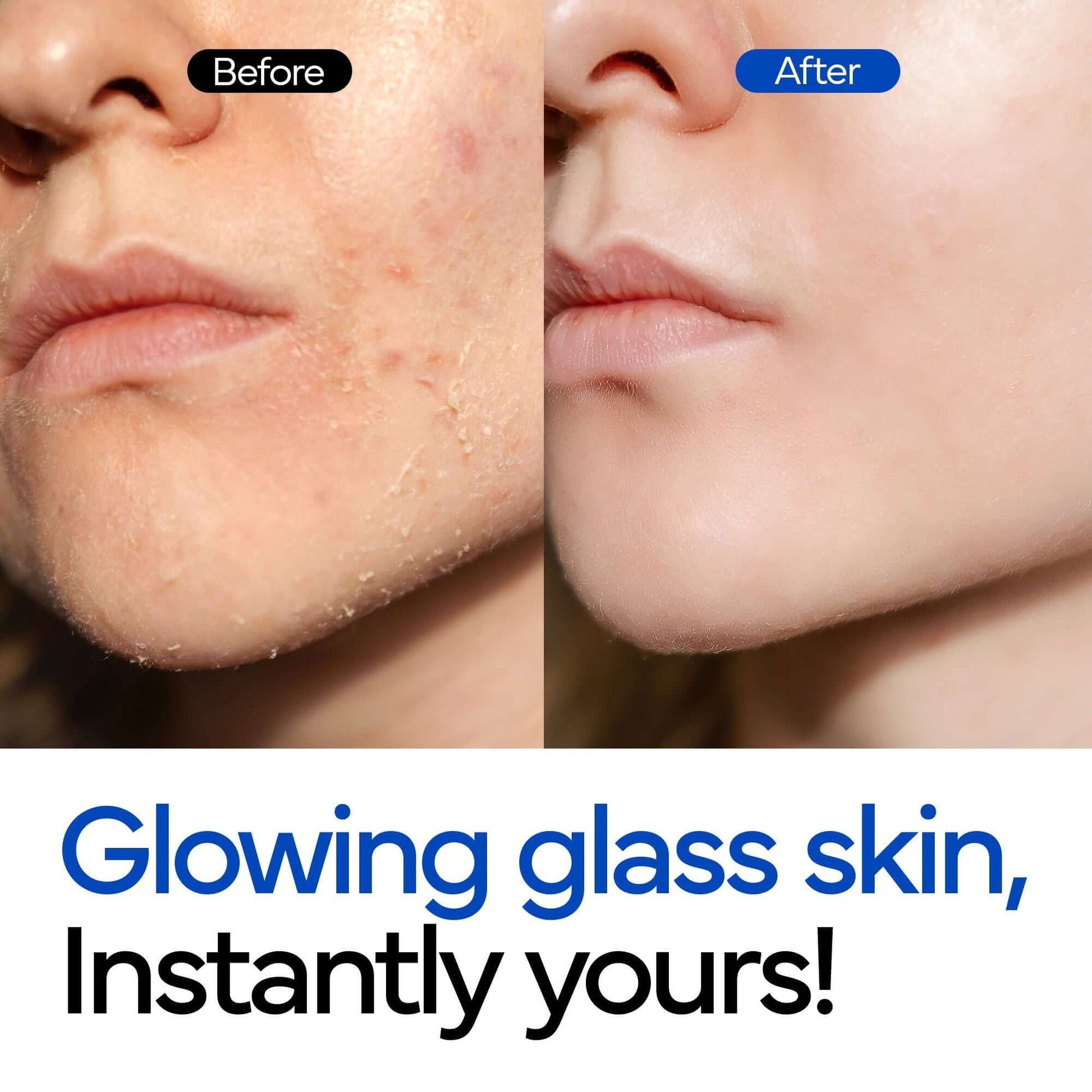 Hydrating Rice Bubble Toner - ivoskin