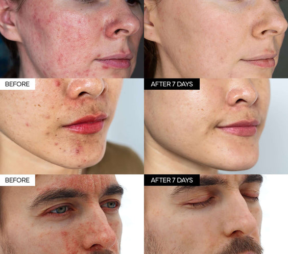 Intensive Cica Repair Cream - ivoskin