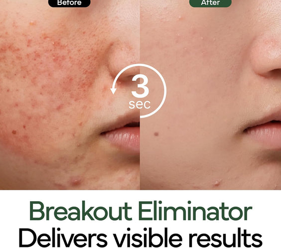 IVOSKIN Repairing Skincare Set